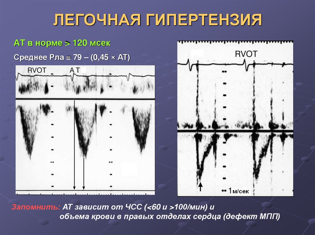 Легочная гипертензия это