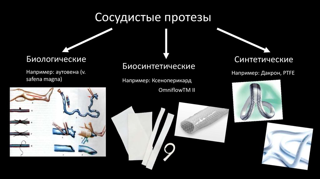 Инструменты протеза