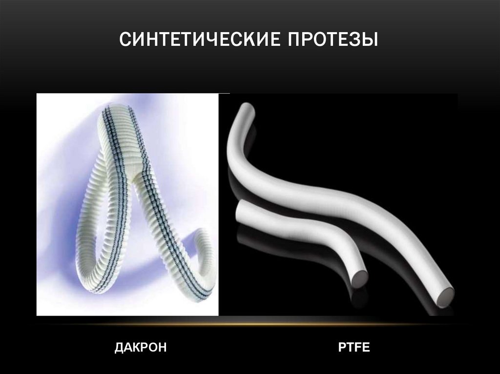 Протезирование сосудов презентация