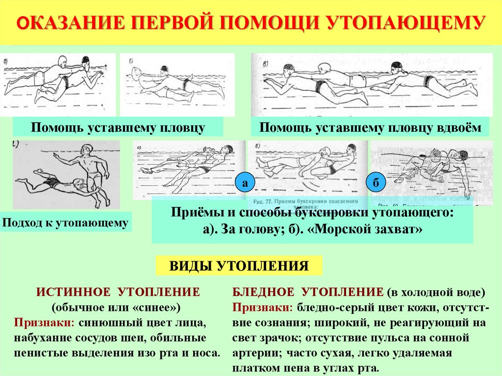 Первая помощь при утоплении в картинках