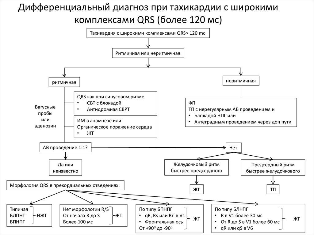 Блок схема аритмии