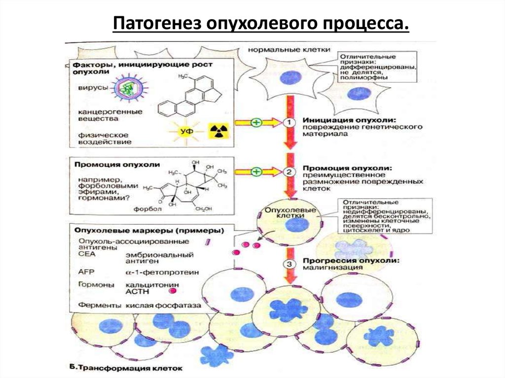 Схема развития опухолей