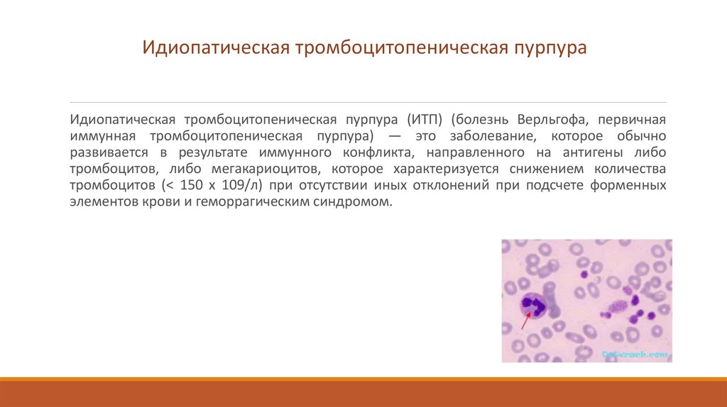 Тромбоцитопения это. Идиопатическая тромбоцитопеническая пурпура картина крови. Идиопатическая тромбоцитопения (болезнь Верльгофа). Тромбоцитопеническую пурпуру (болезнь Верльгофа). Иммунная тромбоцитопеническая пурпура клиника.