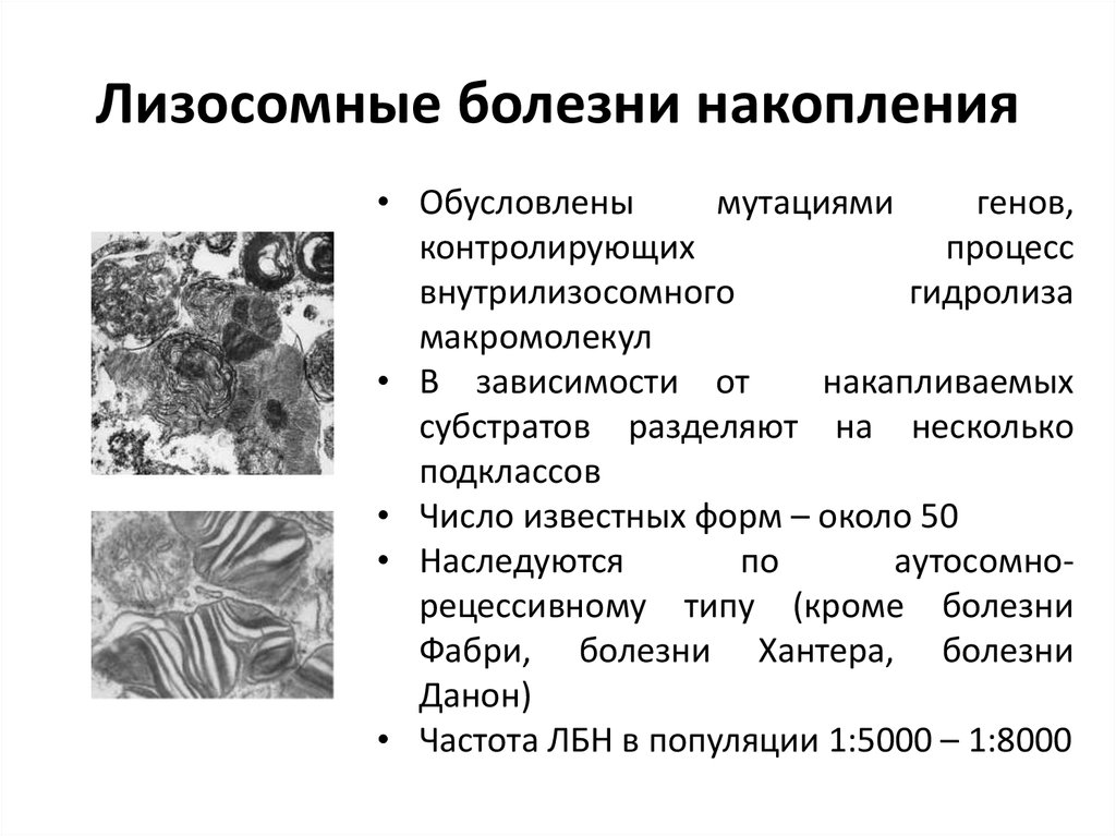 Болезнь гоше презентация генетика