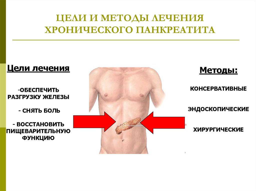 Хирургическое лечение хронического панкреатита