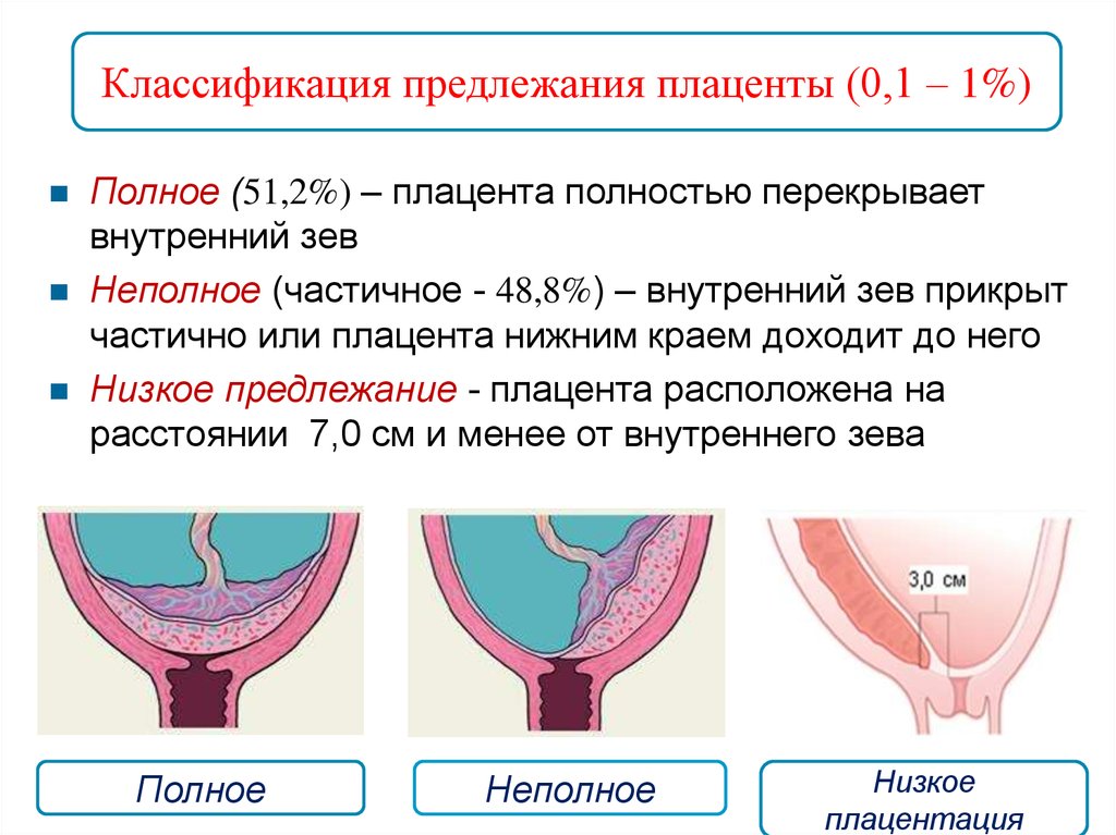 Плацента внутренний зев. Шеечная плацентация. Неполное краевое предлежание плаценты. Плацента край на 24 мм внутреннего зева. Клиническая классификация предлежания плаценты.