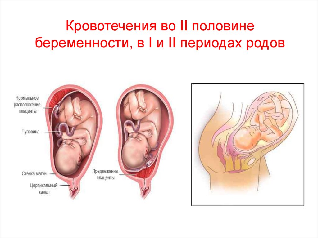 Плацента акушерство презентация