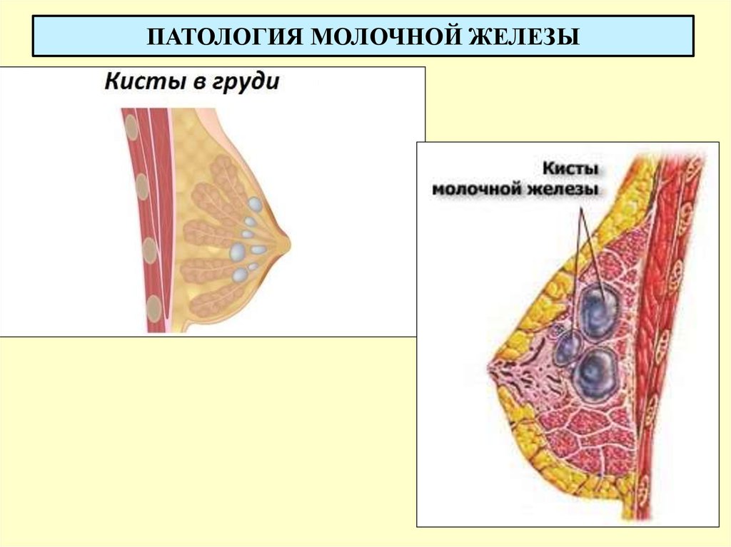 Молочные железы. Молочная железа. Молочные железы женщины. Патология молочных желез. Заболеваниемолочныых желез.