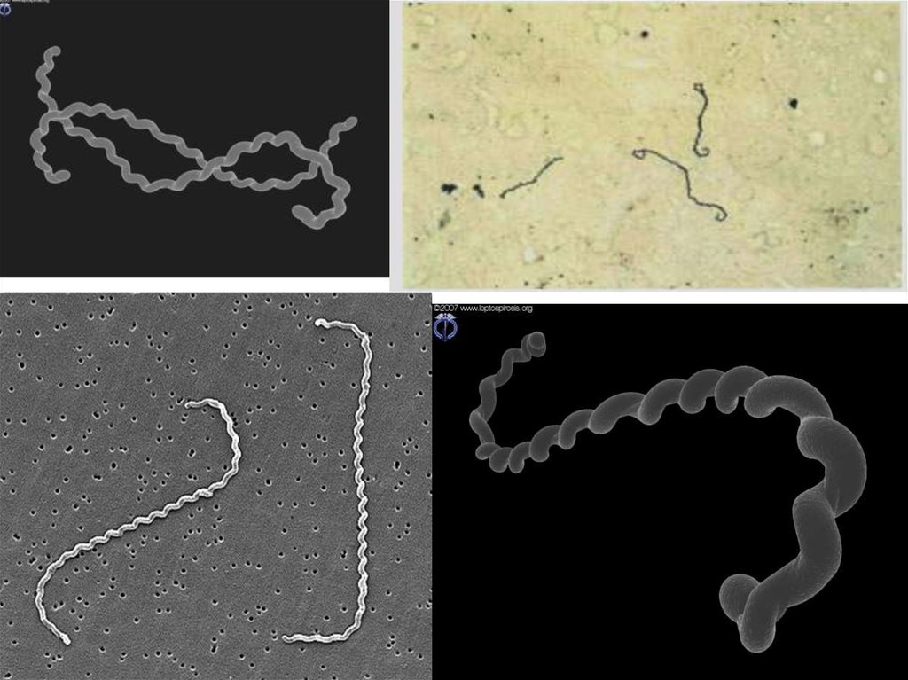 Что такое лептоспироз. Возбудитель лептоспиры. Возбудитель лептоспироза микробиология. Лептоспиры микробиология. Лептоспироз (возбудитель болезни относятся к виду Leptospira interrogans).