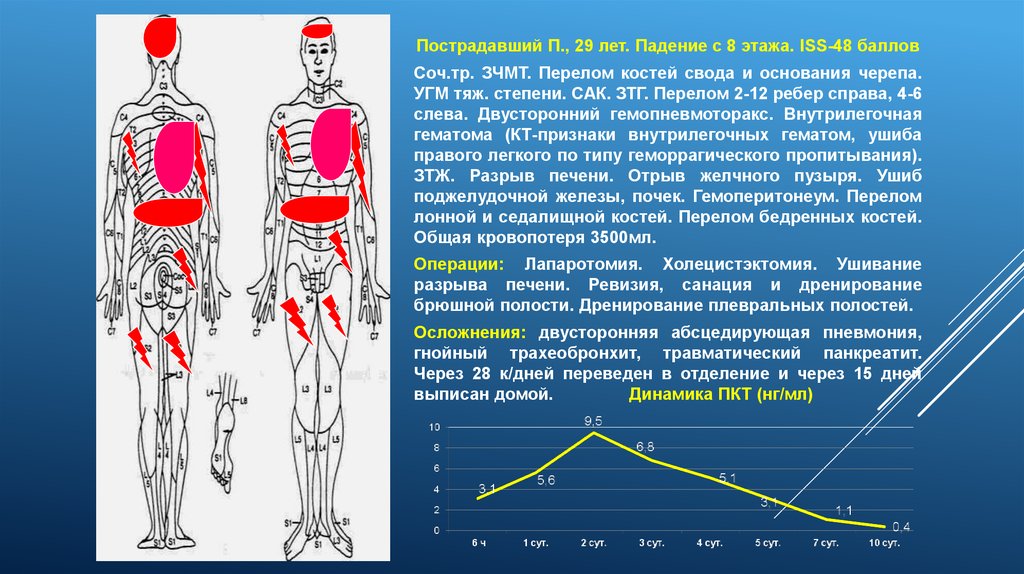 Сочетанная травма хирургия презентация