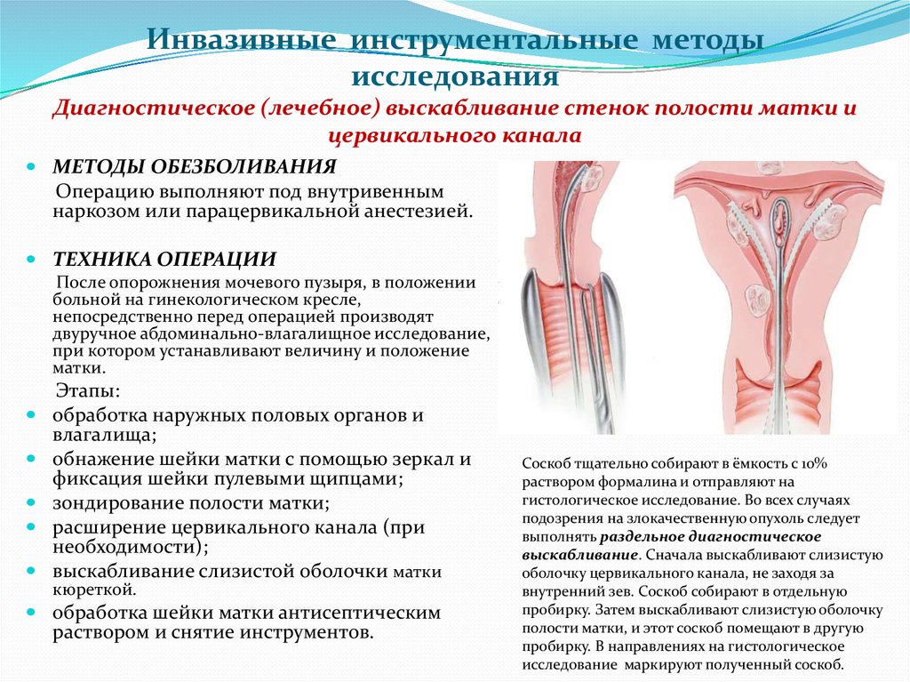 Прямокишечно-влагалищные (ректо-вагинальные) свищи - Клиника урологии МГМСУ