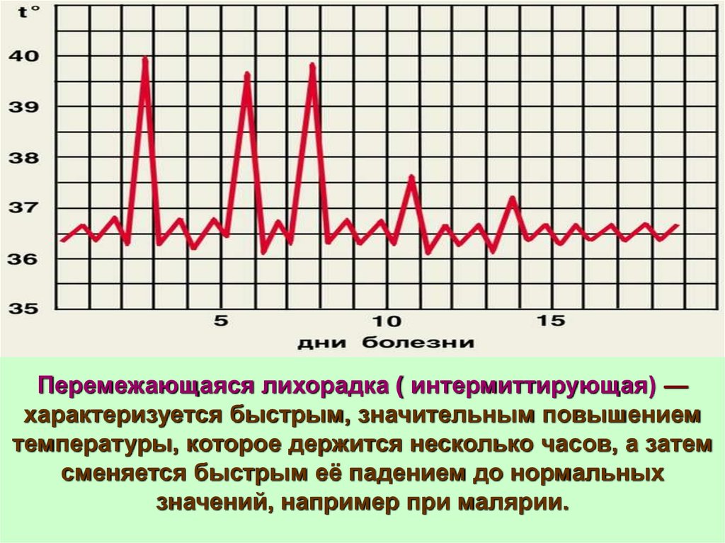 Виды лихорадок по степени колебания температуры в течение суток схема