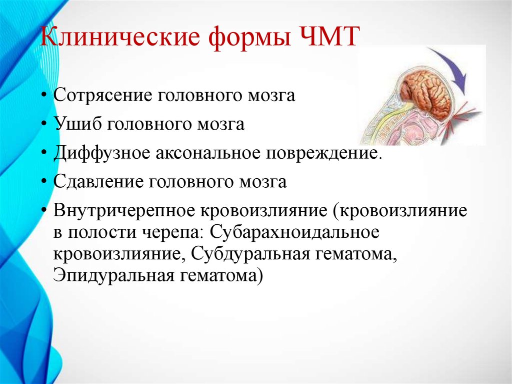 Презентация по чмт