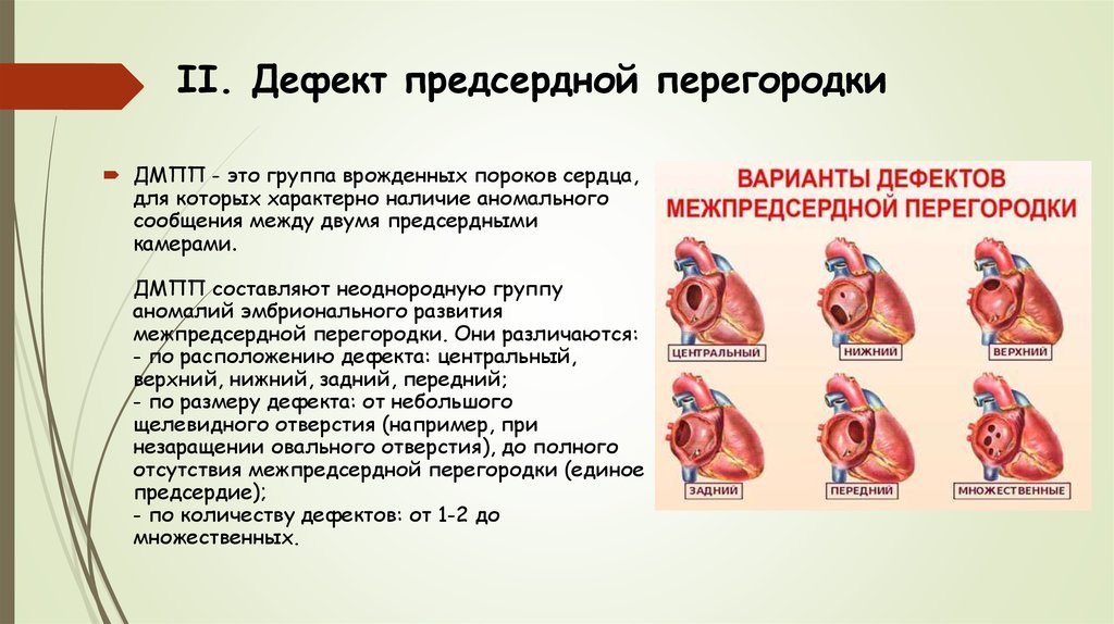 Презентация пороки сердца пропедевтика