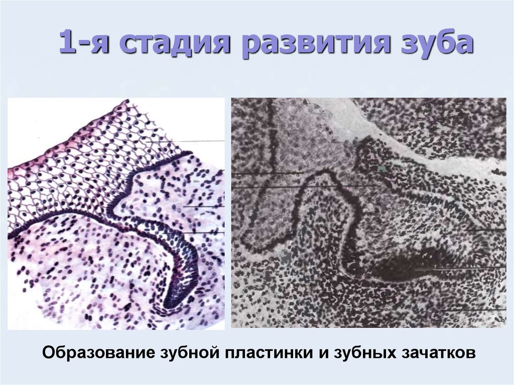 Развитие зуба презентация