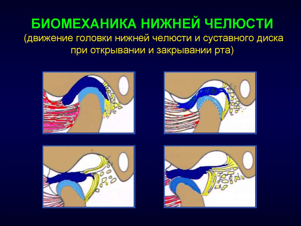 БИОМЕХАНИКА НИЖНЕЙ ЧЕЛЮСТИ (движение головки нижней челюсти и суставного диска при открывании и закрывании рта)