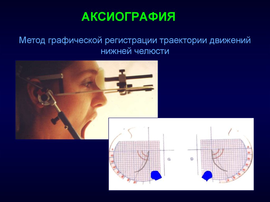 Дополнительные методы обследования внчс презентация