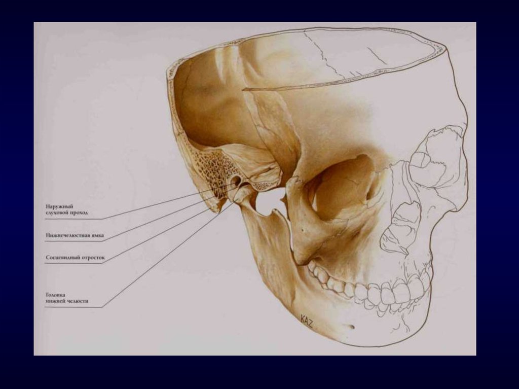 Соединение нижнечелюстной и височных костей. ВНЧС анатомия кости. Анатомия сустава ВНЧС. Височно верхнечелюстной сустав анатомия. Нижнечелюстная ямка ВНЧС.