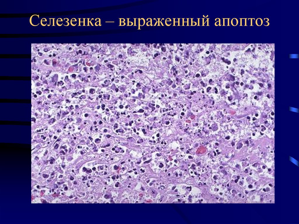 Апоптоз патанатомия презентация