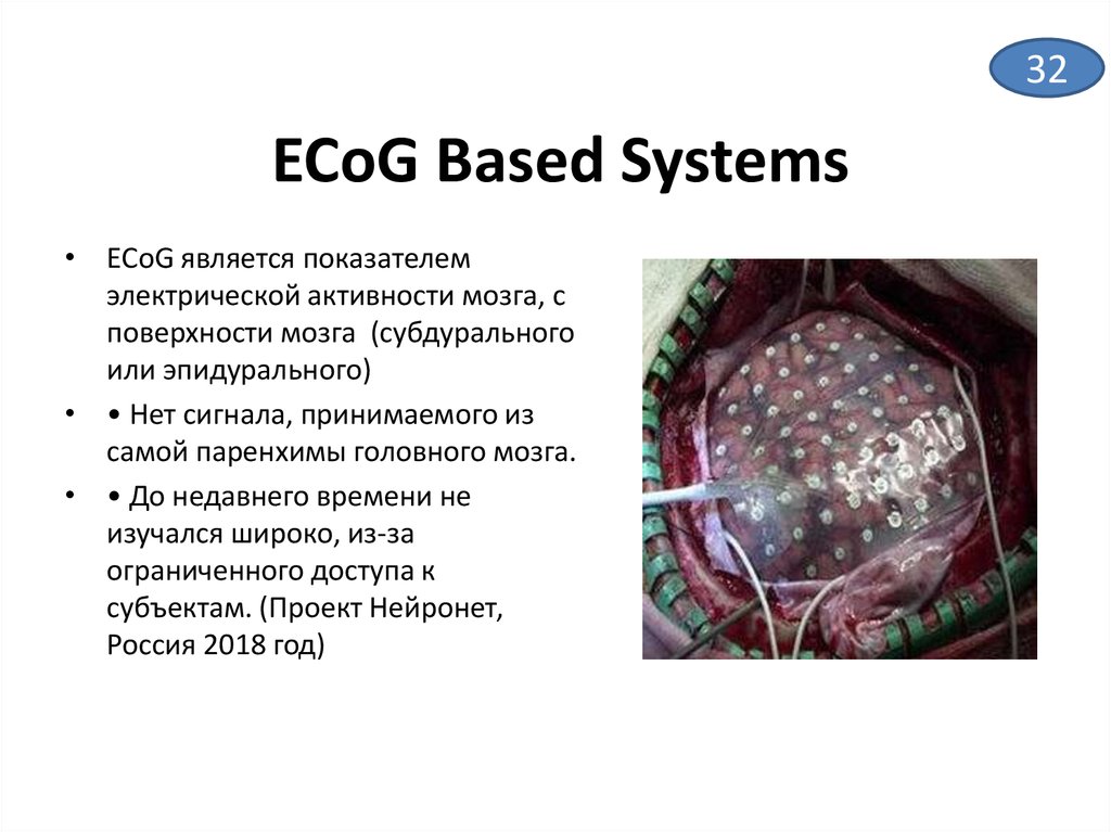 Ecog