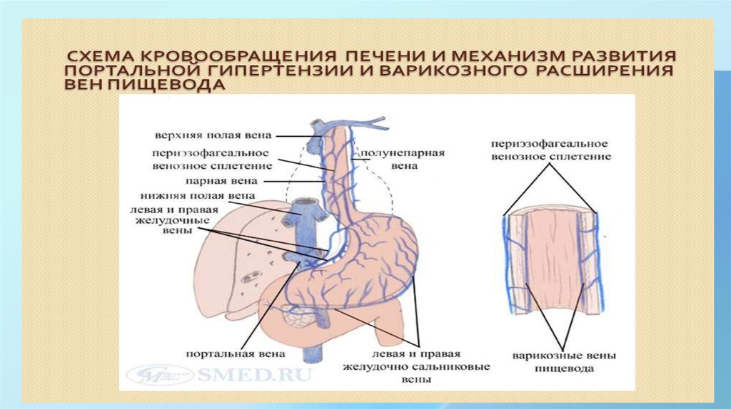 Кровоток печени схема