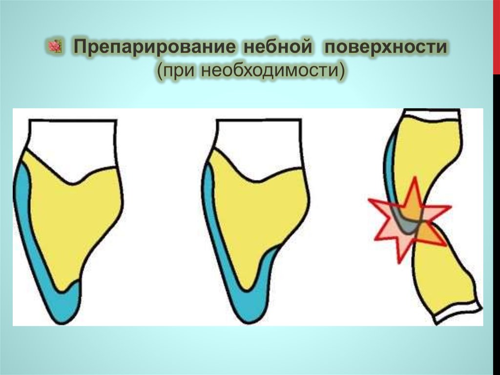 Ооо твс проект тверь