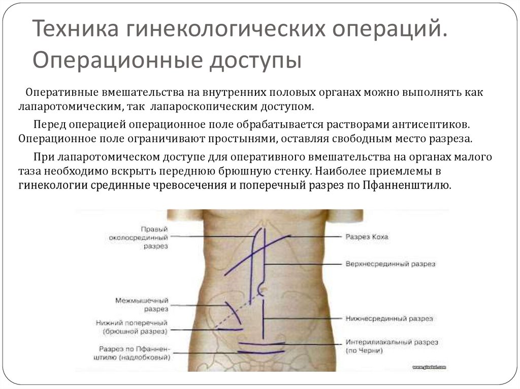 Основные виды гинекологических операций презентация