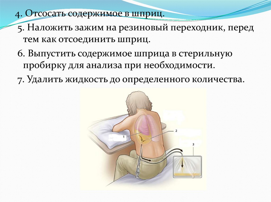 Подготовки пациента к плевральной пункции - презентация онлайн