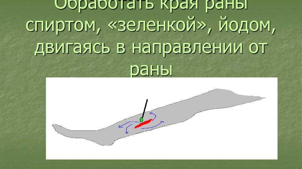 Можно ли зеленкой обрабатывать открытую рану. Правильная обработка раны зеленкой. Рана обработанная зеленкой. Обработка зеленкой открытую рану.