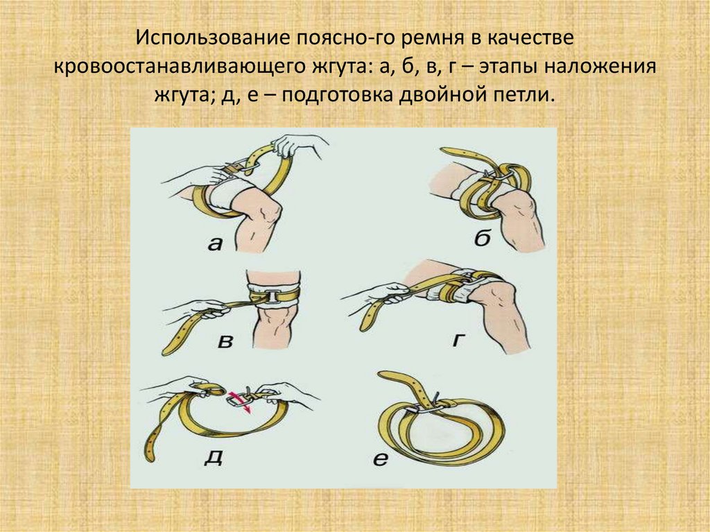 Жгут внутри. Ремня в качестве кровоостанавливающего жгута. Использование поясного ремня в качестве кровоостанавливающего жгута. Кровоостанавливающий жгут из ремня. Кровоостанавливающий жгут из подручных средств.