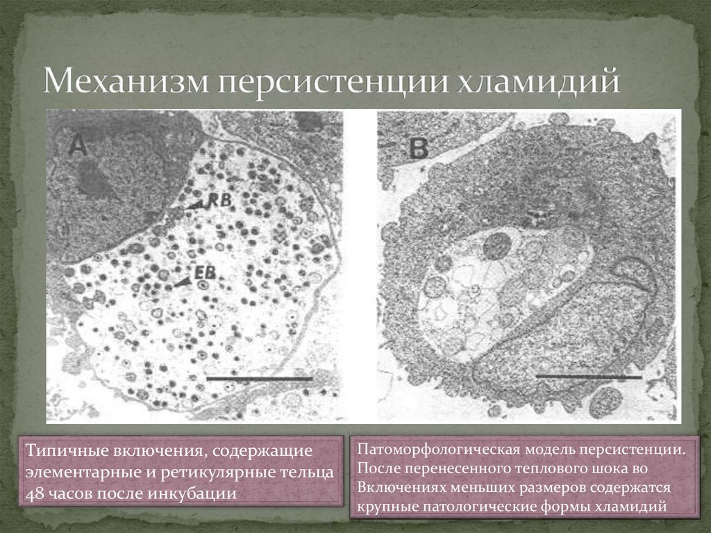Элементарные тельца хламидий. Механизмы персистенции бактерий. Элементарные и ретикулярные тельца хламидий. Жизненный цикл хламидий микробиология.