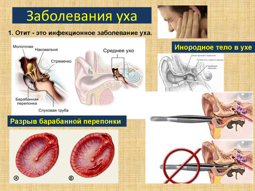 Заболевания уха