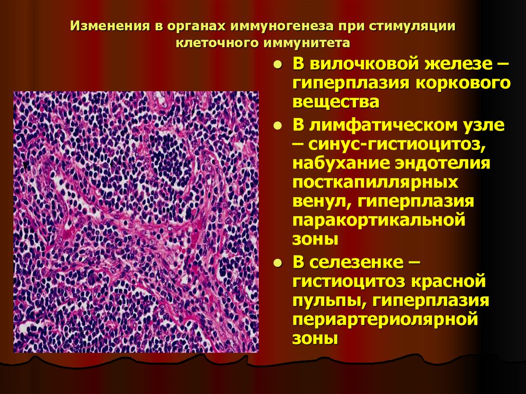 Реактивная гиперплазия лимфоузла. Красная пульпа селезенки гистология. Гуморальный иммунитет патанатомия. Патология тимуса патанатомия. Изменения лимфатических узлов.