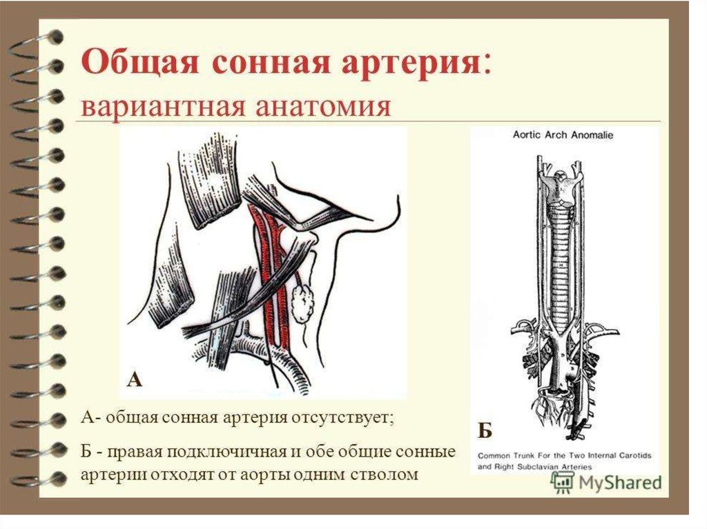 Сонная артерия. Проекционная линия сонной артерии. Общая Сонная артерия. Общая Сонная артерия анатомия. Правая общая Сонная артерия.