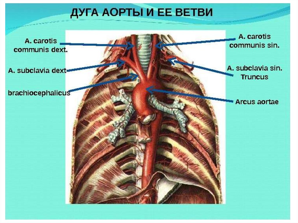 Плечеголовной ствол анатомия. Анатомия сосудов плечеголовной ствол. Сосуды дуги аорты анатомия. Плечеголовная артерия анатомия. Ветви АРКУС аорты.