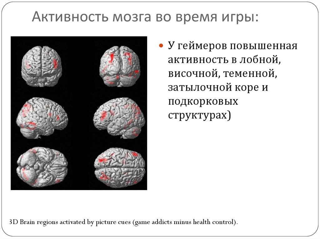 Сон активности мозга