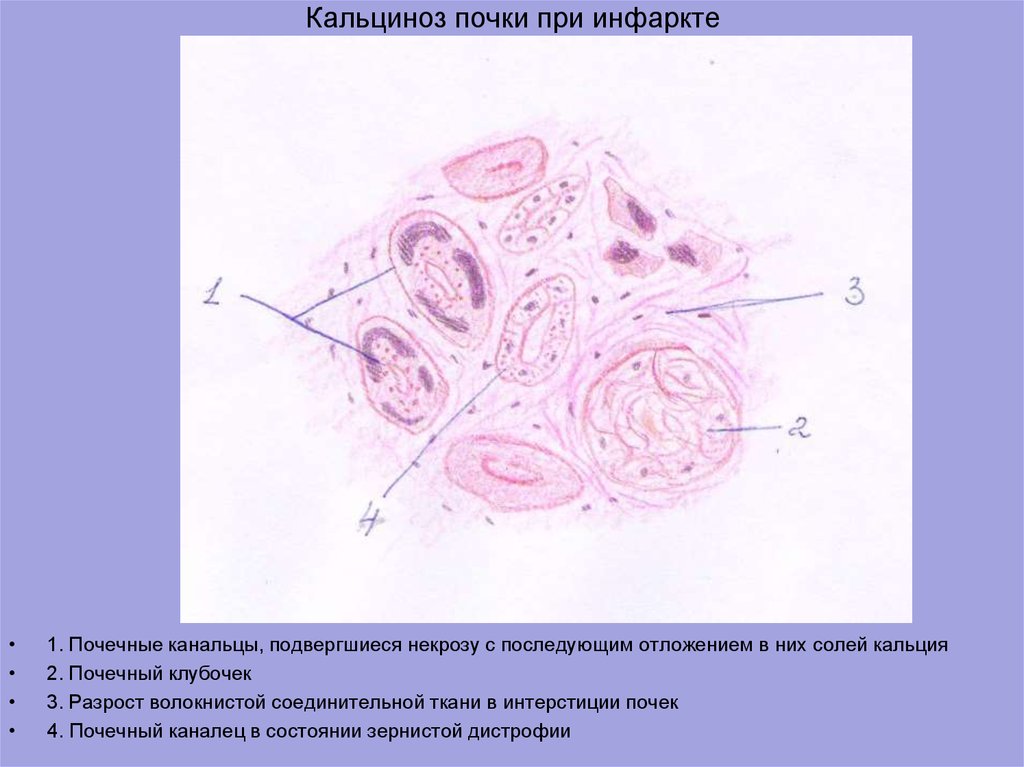 Митральный клапан гистология рисунок