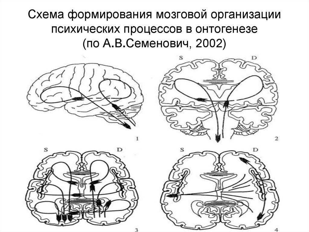 Схема развития головного мозга