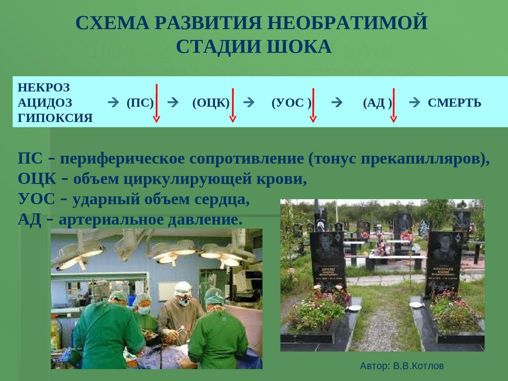 Гипоксия шок. Необратимая стадия шока. Необратимые изменения при шоке. Критерии необратимых изменений при шоке.