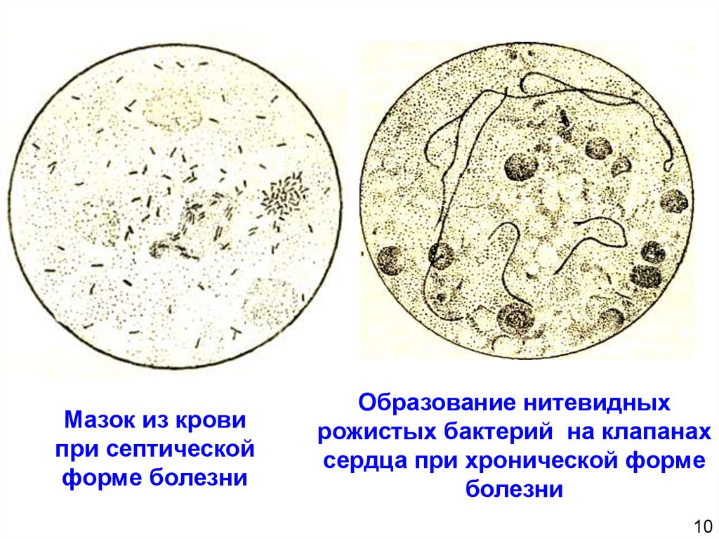 Схема лечения рожи свиней