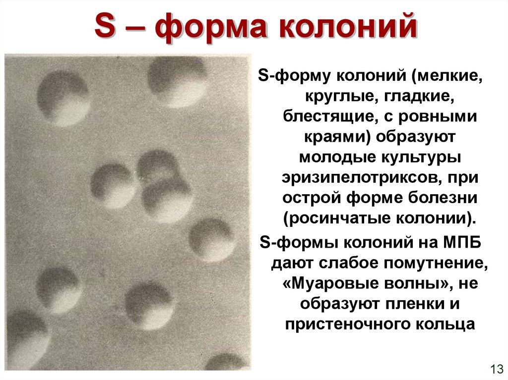 Формы колоний. S форма колоний. R форма колоний. Колонии s и r формы. Круглые колонии s формы.