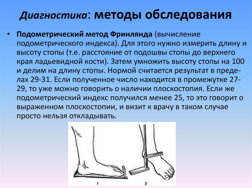 Плоскостопие травматология презентация