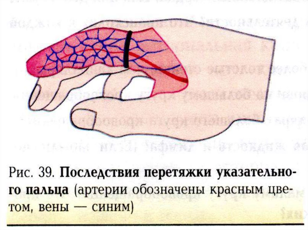 Практическая работа тема кислородное голодание 8 класс. Схема перетяжки пальца. Перетяжка указательного пальца рисунок. Практическая работа кислородное голодание. Практическая работа по биологии 8 кислородное голодание.