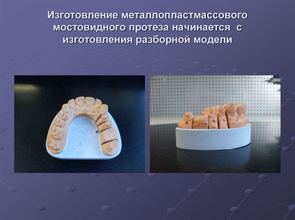 Современные компьютерные технологии ортопедического лечения дефектов коронок зубов презентация