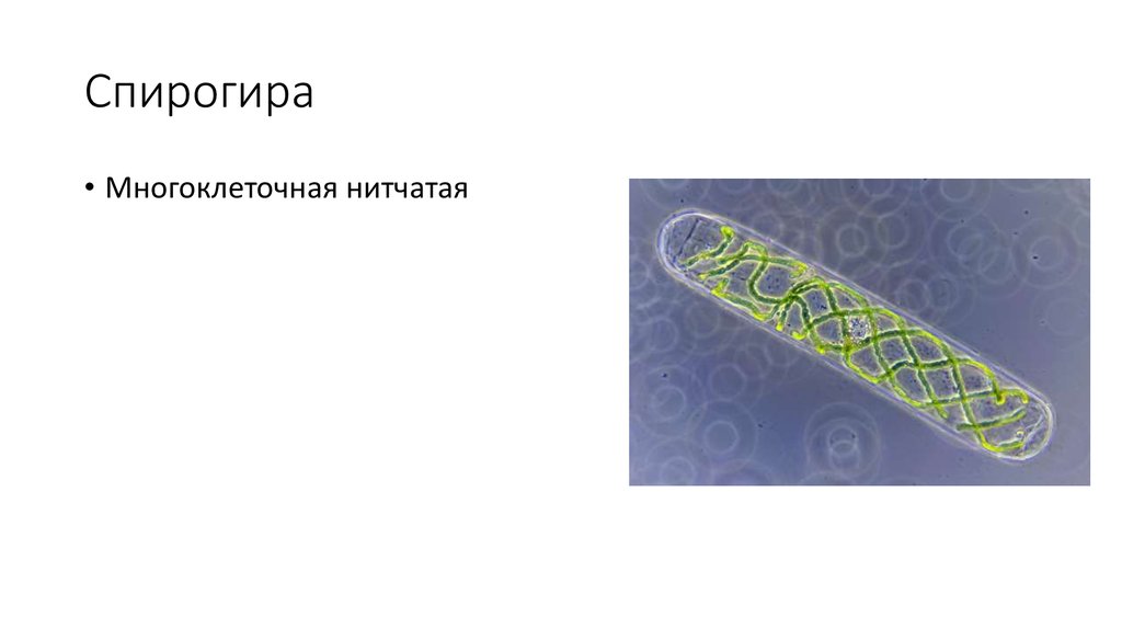 Спирогира одноклеточные. Спирогира. Спирогира многоклеточная. Спирогира под микроскопом. Спирогира царство.