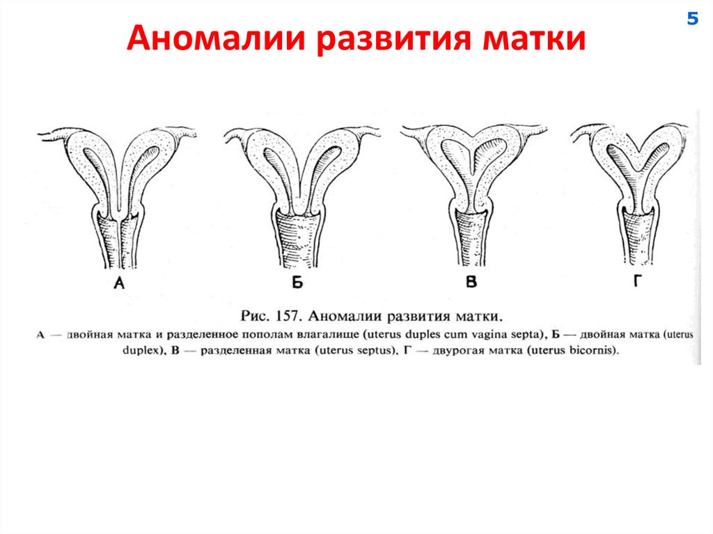 Аномалии женских половых органов презентация