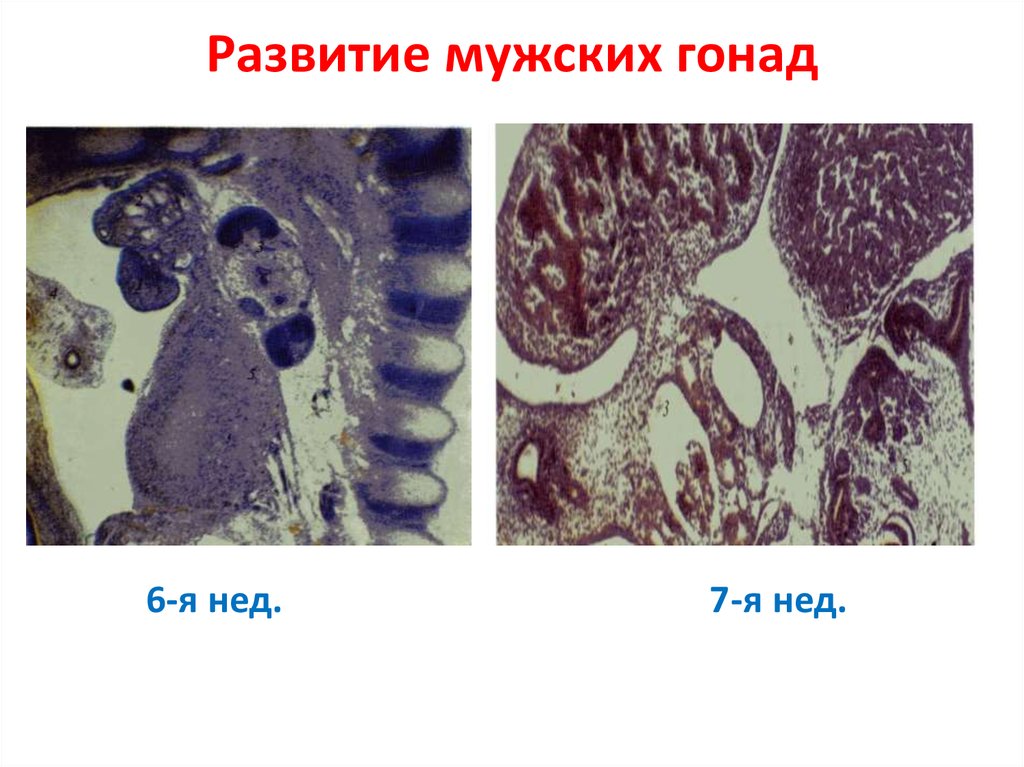 Аномалии развития мужских половых органов презентация