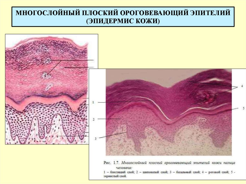 Кожа и слизистые оболочки. Многослойный плоский эпителий кожи. Многослойный плоский неороговевающий эпителий кожи пальца человека. Многослойный плоский ороговевающий эпителий эпидермиса кожи. Многослойный плоский ороговевающий эпителий гистология.