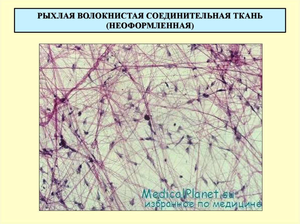 Плотная волокнистая неоформленная соединительная ткань рисунок