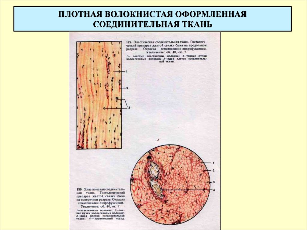 Эластическая связка. Плотная оформленная соединительная ткань эластическая связка. Эластическая соединительная ткань выйная связка. Плотная волокнистая соединительная ткань поперечный срез. Плотная оформленная соединительная ткань. Эластическая связка быка..